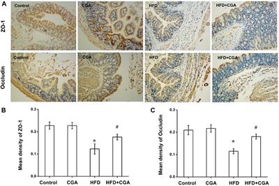 Chlorogenic Acid Improves NAFLD by Regulating gut Microbiota and GLP-1